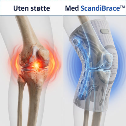 Uten støtte vs med ScandiBrace